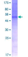 Human CD47 Protein (Recombinant GST)