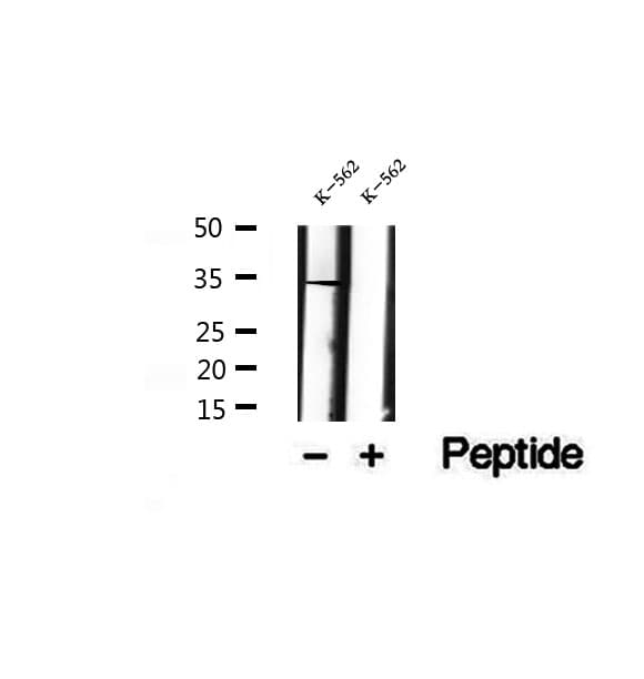 EIF2B1 Antibody