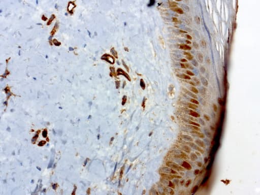 PECAM-1 / CD31 Antibody (clone UMAB29)