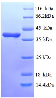Human ANXA3 / Annexin A3 Protein (Recombinant His)