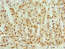 STMN4 / RB3 Antibody (aa1-216)