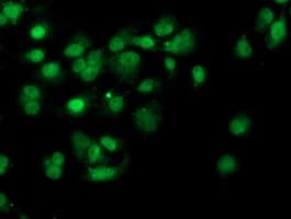 PDSS2 / DLP1 Antibody (clone OTI1C4, Carrier-free)