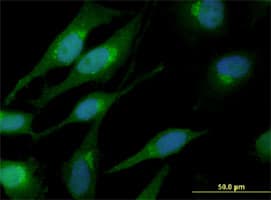 CTNNB1 / Beta Catenin Antibody (clone 1C9)