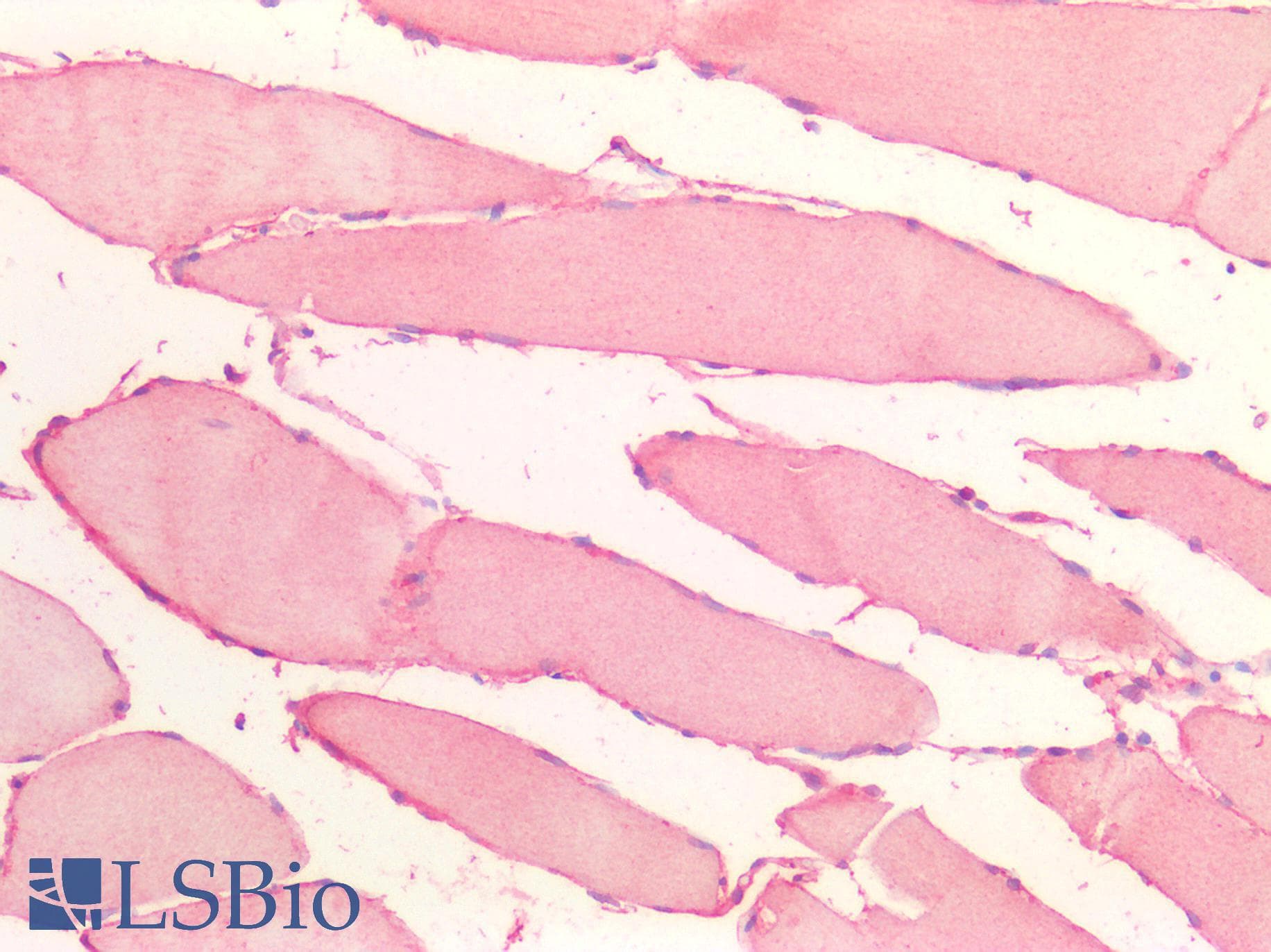 IHC-plus™ CDH13 / Cadherin 13 Antibody