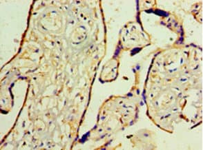 Polyclonal Rabbit anti-Human WT1 / Wilms Tumor 1 Antibody (aa1-449, IHC)