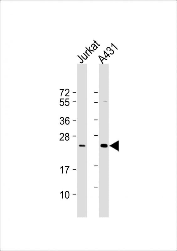 Monoclonal Mouse anti-Human RAB29 / RAB7L1 Antibody (clone 1789CT823.71.1.1, WB)