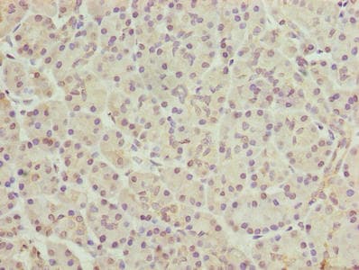 Polyclonal Rabbit anti-Human FAR2 Antibody (IHC)