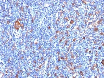 FSCN1 / Fascin Antibody (clone FSCN1/417)