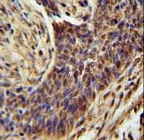 Polyclonal Rabbit anti-Human ZSWIM1 Antibody (aa443-471, IHC, WB)
