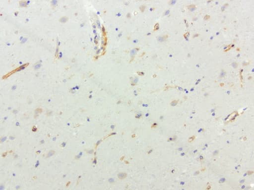 SQSTM1 Antibody (clone UMAB13, Carrier-free)