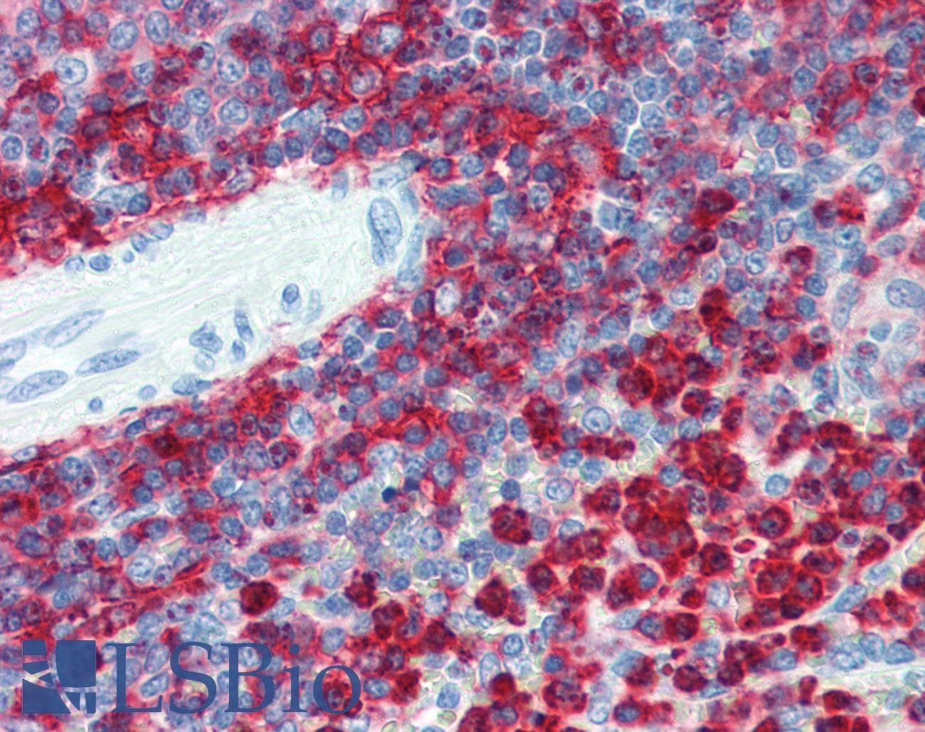 IHC-plus™ ITGB2 / CD18 Antibody (aa534-546, clone MEM-48, Low Endotoxin)