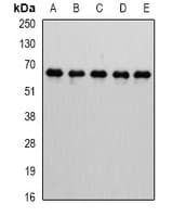 Polyclonal Rabbit anti-Human CBFA2T2 / MTGR1 Antibody (IF, WB)