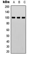 RBBP8 / CTIP Antibody (Internal)
