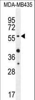 Polyclonal Rabbit anti-Human AKT1 Antibody (Thr308, IHC, WB)
