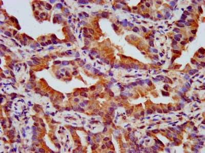 Polyclonal Rabbit anti-Human NPHP4 Antibody (IHC, IF)