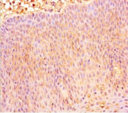 Polyclonal Rabbit anti-Human CXCR4 Antibody (IHC, WB)