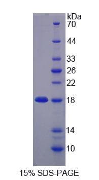 Human ZNRD1 Protein (Recombinant His-S)