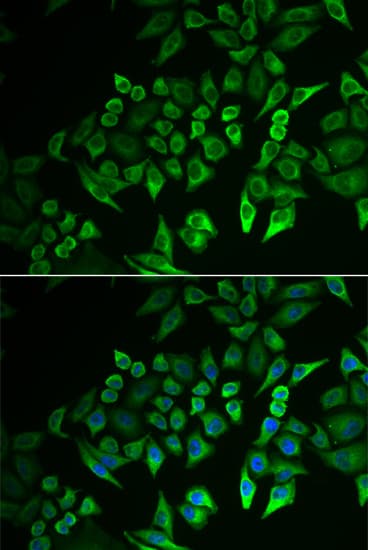 INPP5J / PIB5PA Antibody