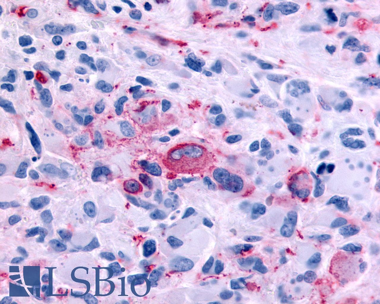 PathPlus™ Polyclonal Rabbit anti-Human RXFP2 / LGR8 Antibody (Extracellular Domain, IHC)