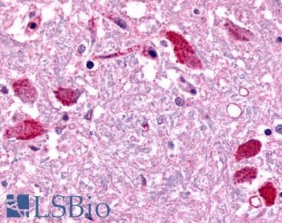 PathPlus™ Polyclonal Rabbit anti-Human ADGRE2 / EMR2 Antibody (N-Terminus, IHC)