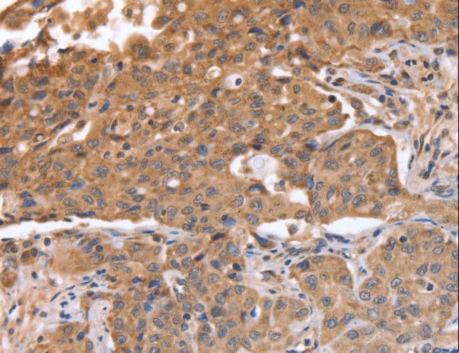 IHC-plus™ ABCB6 Antibody