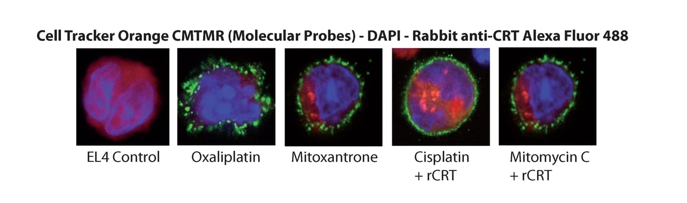 Human CALR / Calreticulin Protein (Recombinant His)