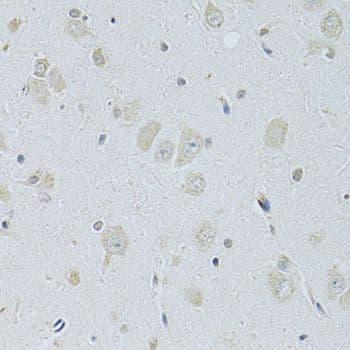SLC29A1 / ENT1 Antibody