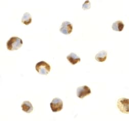 Polyclonal Rabbit anti-Human C1QTNF7 / CTRP7 Antibody (IF, WB)