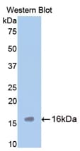 Tryptase Antibody (aa149-273)