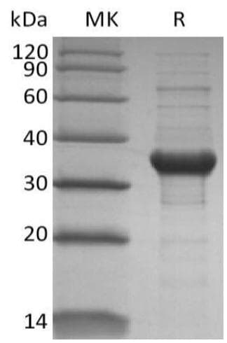 Coronavirus SARS-CoV-2 Orf1ab Polyprotein (Recombinant)