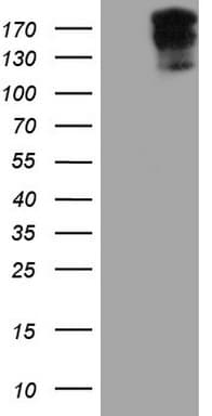 DMN / Desmuslin / Synemin Antibody (aa329-580, clone OTI7A9, Carrier-free)