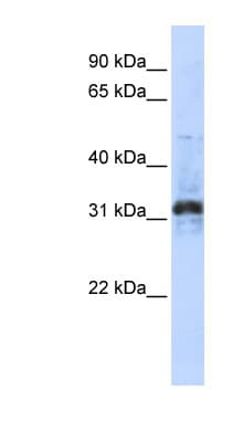 METTL10 Antibody (C-Terminus)