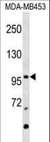 Mineralocorticoid Receptor Antibody (aa654-683)