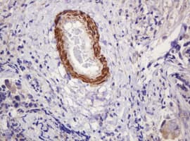 PADI4 / PAD4 Antibody (clone OTI5C10)