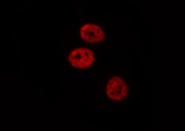Polyclonal Rabbit anti-Human PAWR / PAR4 Antibody (IHC, IF, WB)