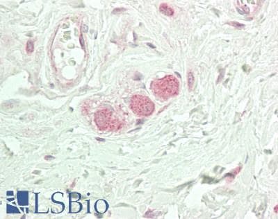 IHC-plus™ CRBN / Cereblon Antibody
