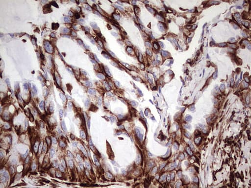 Vimentin Antibody (clone UMAB160, Carrier-free)