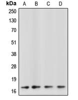 CASP3 / Caspase 3 Antibody (Internal)