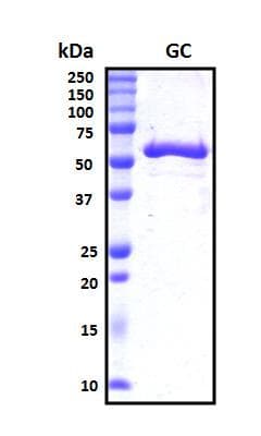 Human GC / Vitamin D-Binding Protein (Recombinant His, N-Terminal)