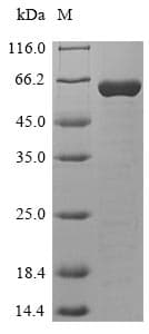 Human HPF1 Protein (Recombinant 10His-SUMO, N-terminus + Myc, C-terminus)