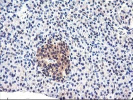 CYP2J2 Antibody (clone OTI5C5)