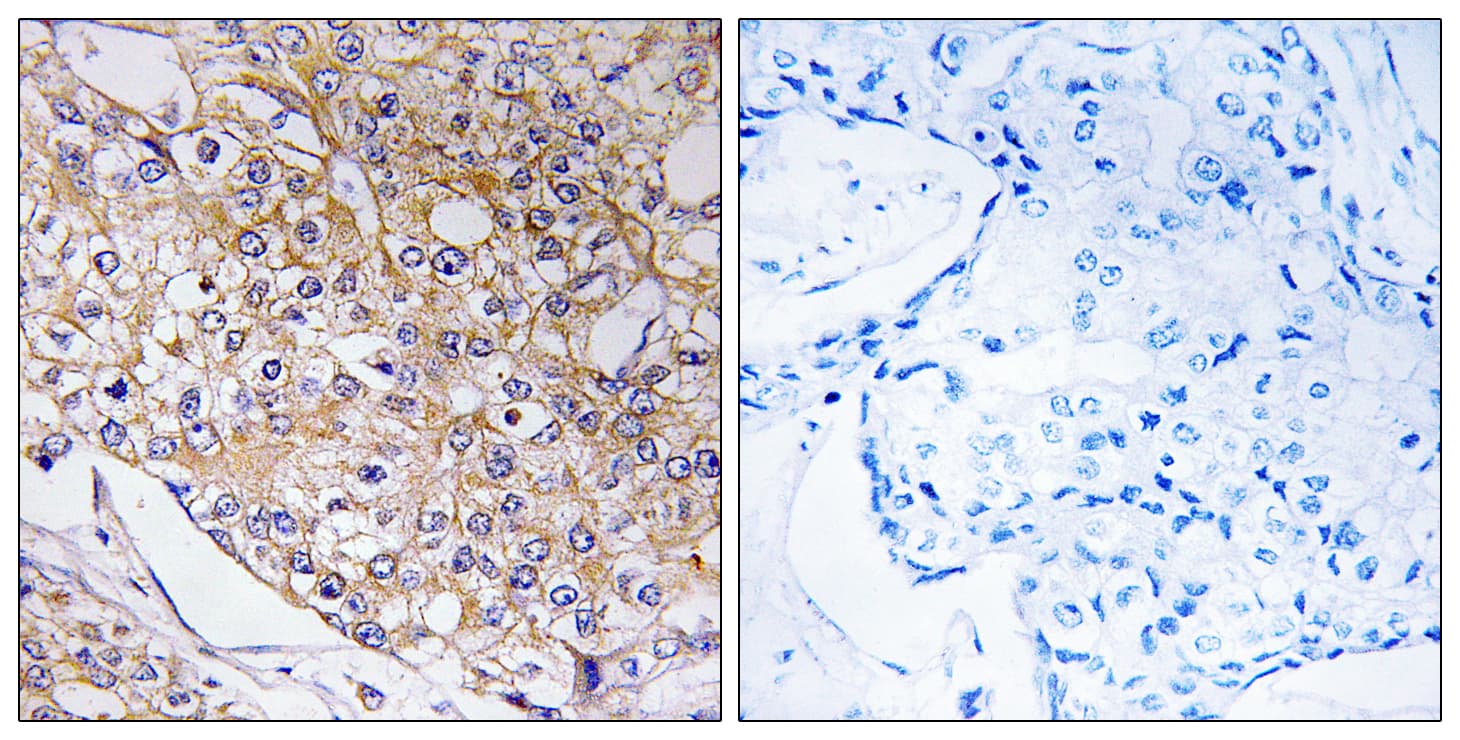 TRAPPC1 / MUM2 Antibody (aa10-59)
