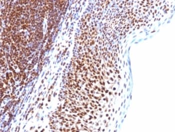 SUMO1 / SMT3 Antibody (clone SUMO1/1188, Ready-to-Use)