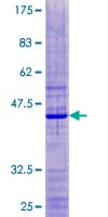 Human RPS18 / Ribosomal Protein S18 (Recombinant GST)
