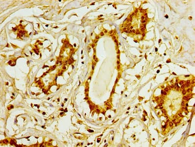 UCP1 / UCP-1 Antibody