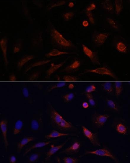 CLDN5 / Claudin 5 Antibody