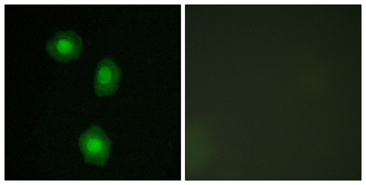 RPS6KA5 / MSK1 Antibody (p376)