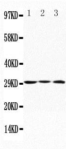 APOD / Apolipoprotein D Antibody (aa172-189)
