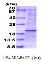 Human RPL35 / Ribosomal Protein L35 (Recombinant His)