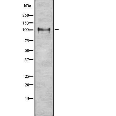 Polyclonal Rabbit anti-Human ITCH / AIP4 Antibody (WB)